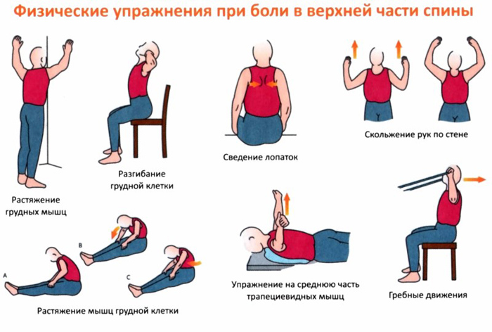 Упражнения при болях в верхней части спины