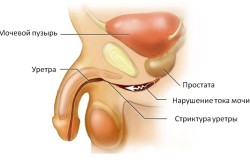 Уретра в мочеполовой системе