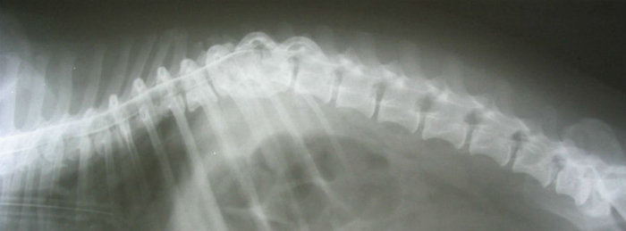 Дисторсия на снимке рентгенографии