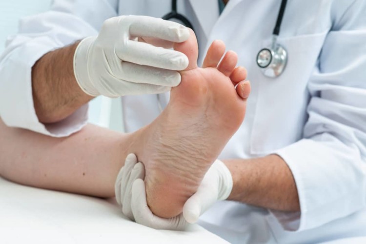 Грибок между пальцами ног: симптомы и лечение, признаки заболевания | s .