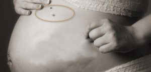 папилломы при беременности 