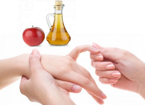 С помощью яблочного уксуса можно лечить артрит пальцев рук