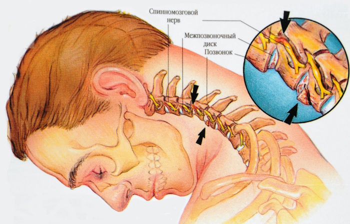Анатомия шейного отдела позвоночника