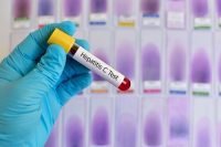 Рекомендуется выполнение теста 321 вирус гепатита с кач анализ thumbnail