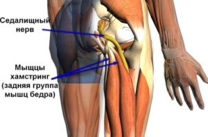 Симптомы и лечение защемления нерва в тазобедренном суставе
