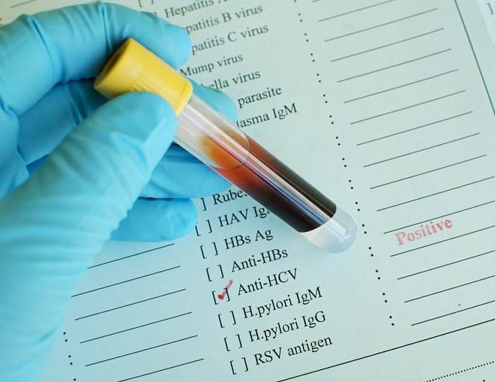 Общий анализ крови при гепатите