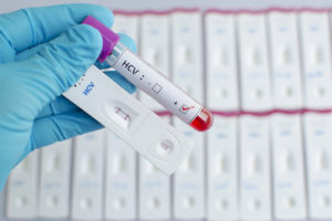 положительный результат анализа на гепатит требует дополнительной проверки