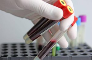 анализ крови нужно сдать для определения онкологии