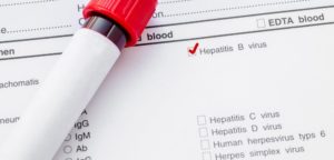  Анализ на гепатит В – это обнаружение в крови HBs-антигена