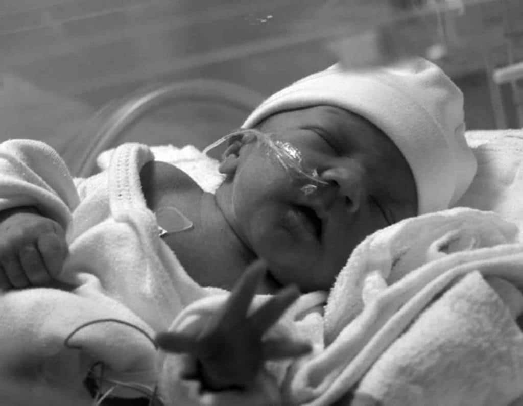 Врожденная пневмония у новорожденных